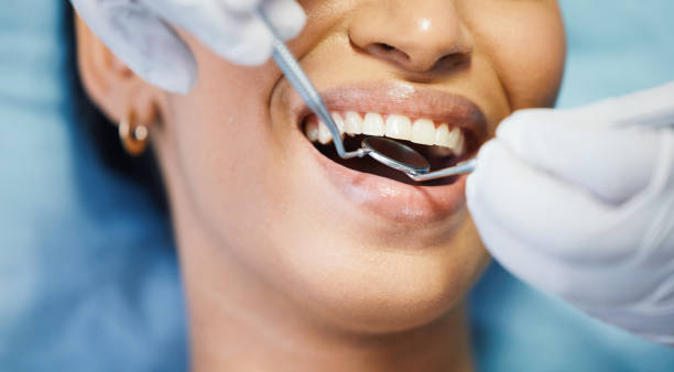 Best Emergency Dental Care for Broken or Chipped Teeth in Wanatah, IN