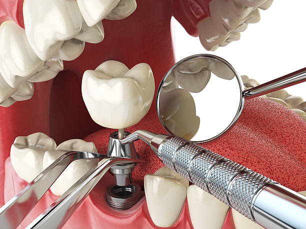 Best Same-Day Emergency Dental Services in Wanatah, IN